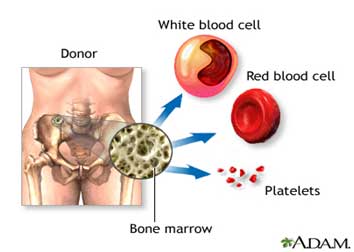 Bone Marrow Diagram