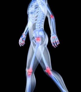 X-ray Showing Pain throughout Body
